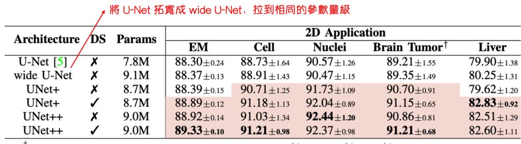 UNetpp_3