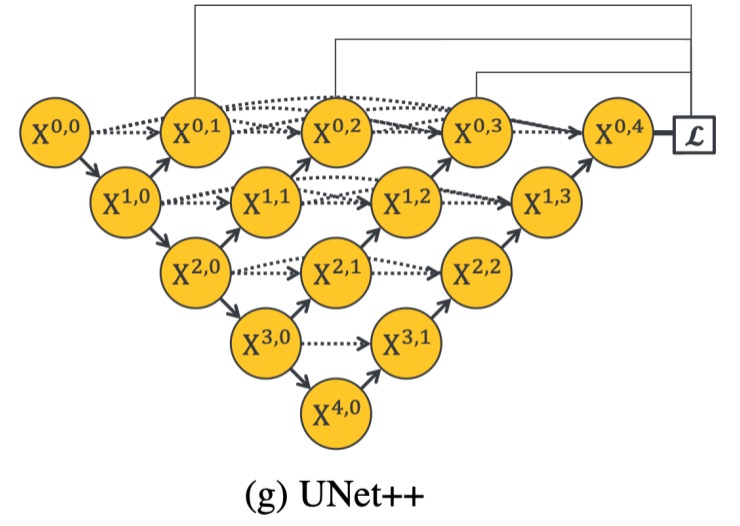 UNetpp_4